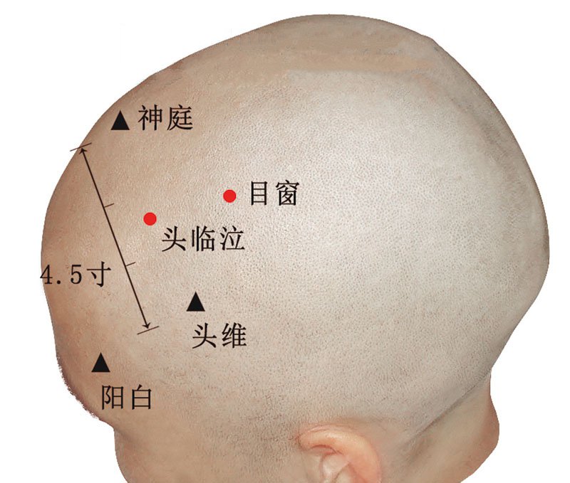 头临泣穴准确位置视频图作用功效配穴方法